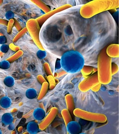Bakterien setzen sich fest